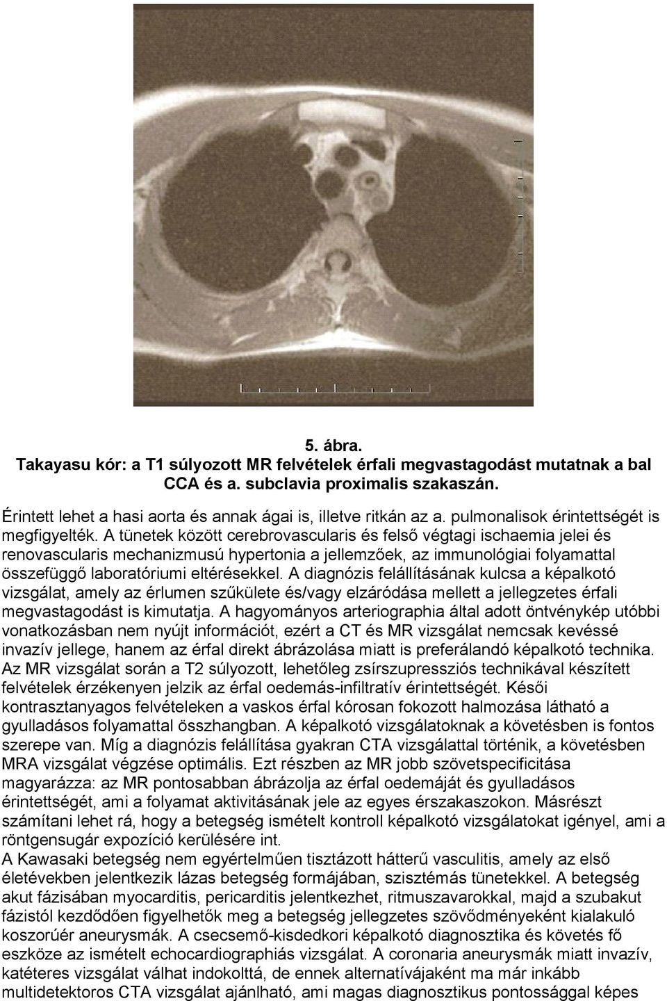 A tünetek között cerebrovascularis és felső végtagi ischaemia jelei és renovascularis mechanizmusú hypertonia a jellemzőek, az immunológiai folyamattal összefüggő laboratóriumi eltérésekkel.