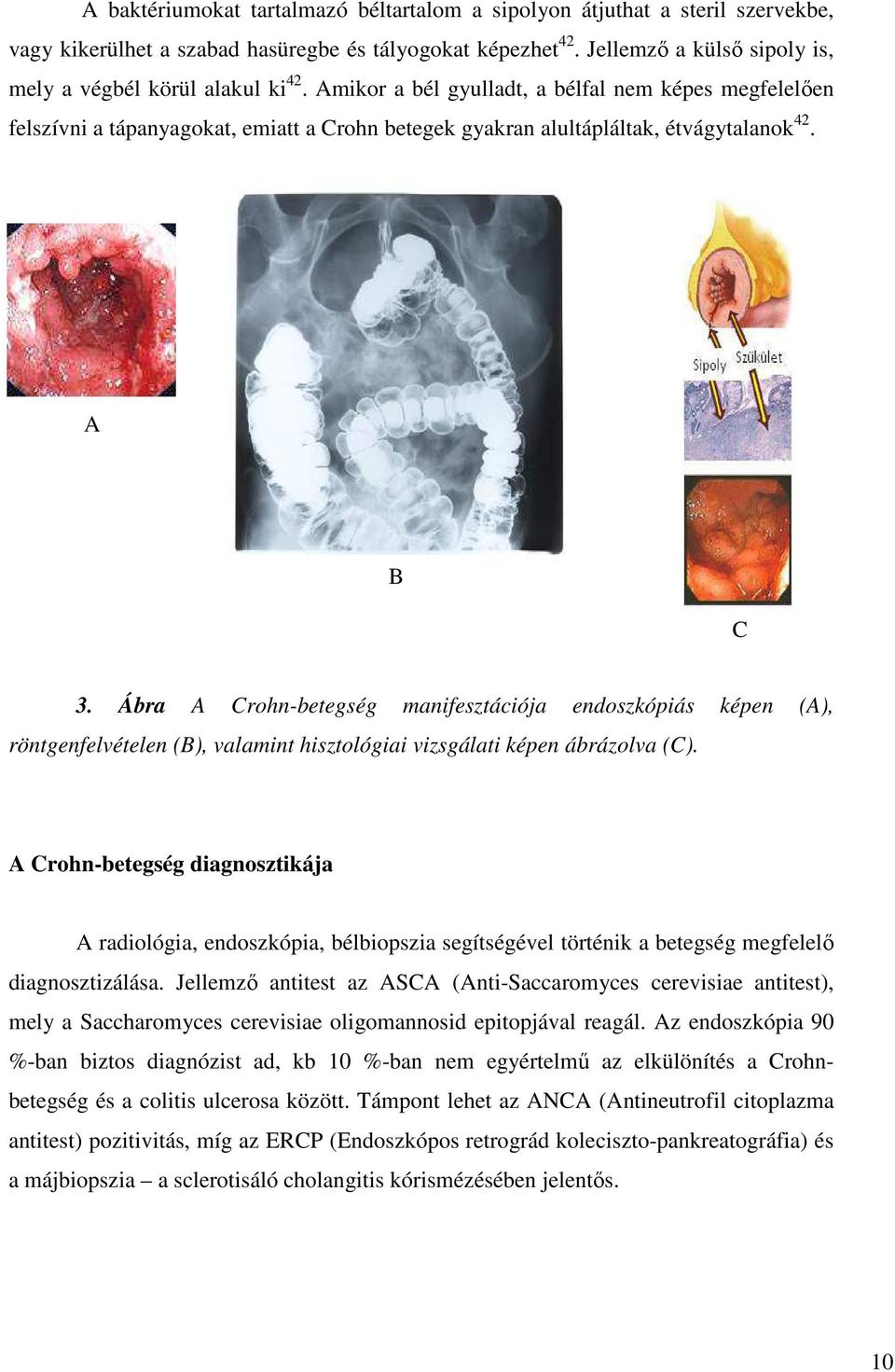 Amikor a bél gyulladt, a bélfal nem képes megfelelően felszívni a tápanyagokat, emiatt a Crohn betegek gyakran alultápláltak, étvágytalanok 42. A B C 3.