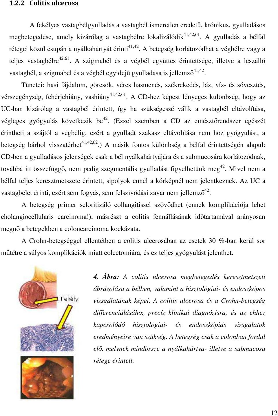 A szigmabél és a végbél együttes érintettsége, illetve a leszálló vastagbél, a szigmabél és a végbél egyidejű gyulladása is jellemző 41,42.