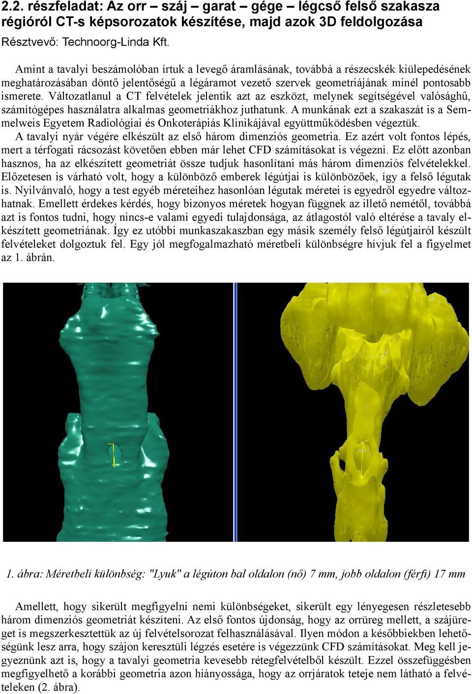 Változatlanul a CT felvételek jelentik azt az eszközt, melynek segítségével valósághű, számítógépes használatra alkalmas geometriákhoz juthatunk.