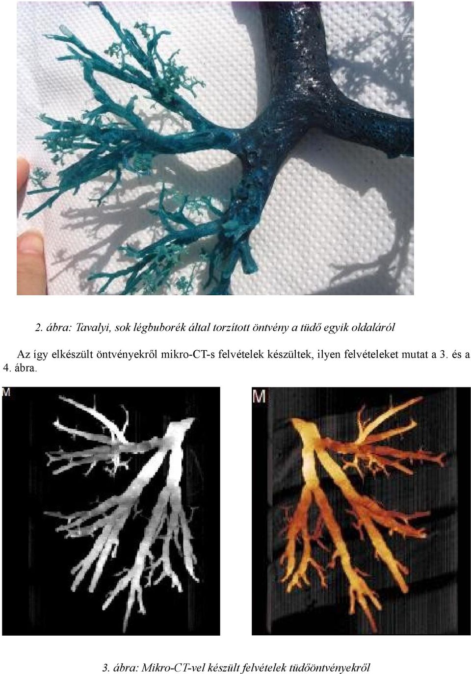 mikro-ct-s felvételek készültek, ilyen felvételeket mutat a
