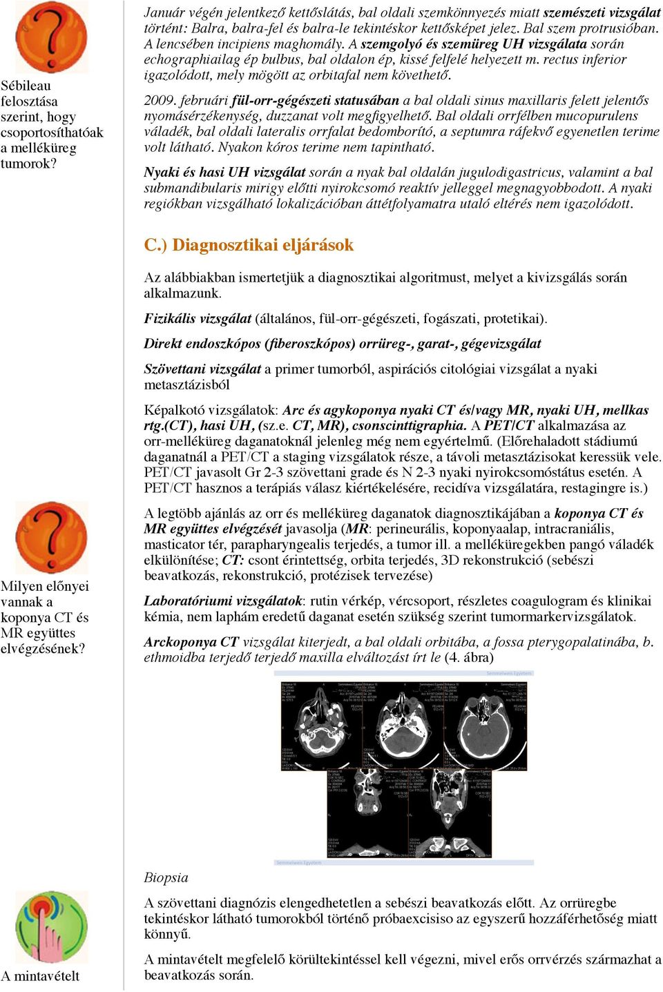 A lencsében incipiens maghomály. A szemgolyó és szemüreg UH vizsgálata során echographiailag ép bulbus, bal oldalon ép, kissé felfelé helyezett m.