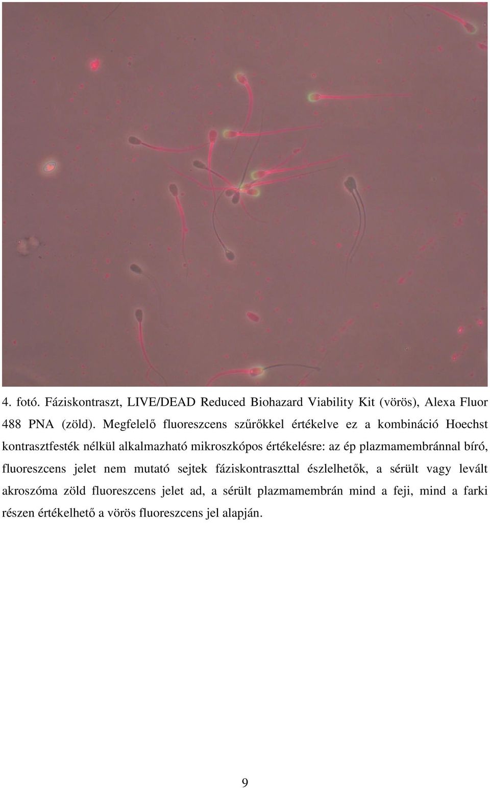 értékelésre: az ép plazmamembránnal bíró, fluoreszcens jelet nem mutató sejtek fáziskontraszttal észlelhetők, a sérült