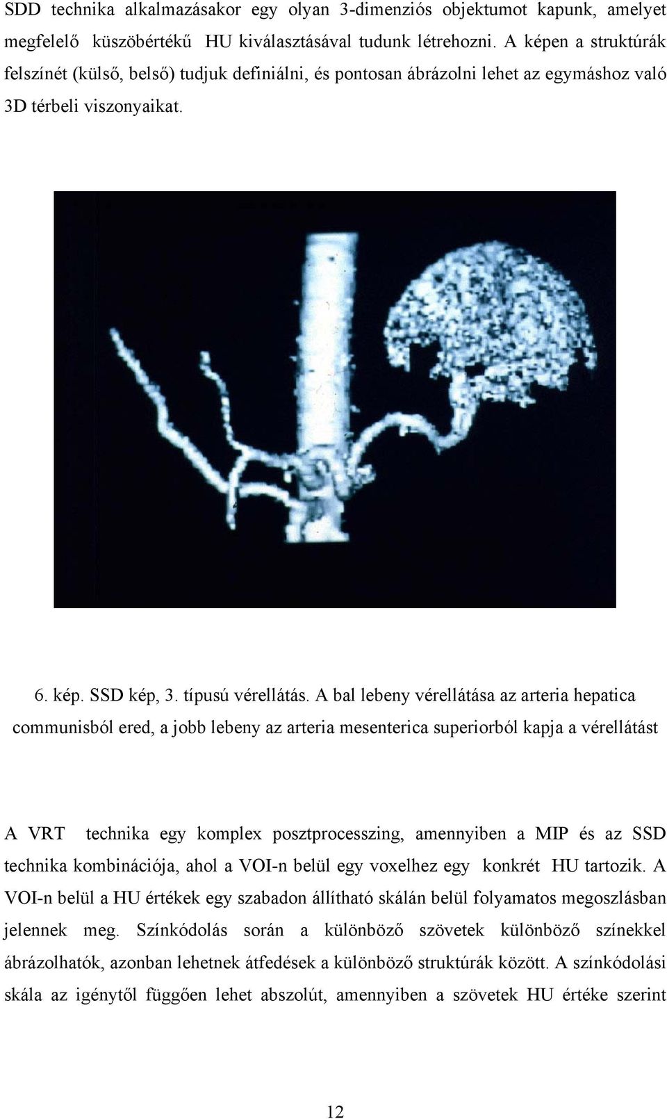 A bal lebeny vérellátása az arteria hepatica communisból ered, a jobb lebeny az arteria mesenterica superiorból kapja a vérellátást A VRT technika egy komplex posztprocesszing, amennyiben a MIP és az
