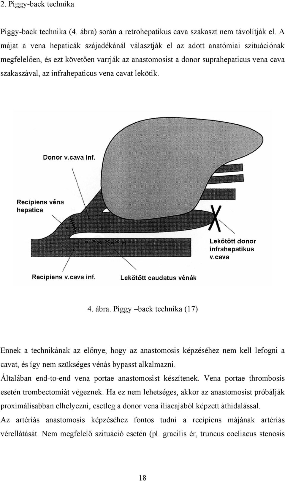 infrahepaticus vena cavat lekötik. 4. ábra.