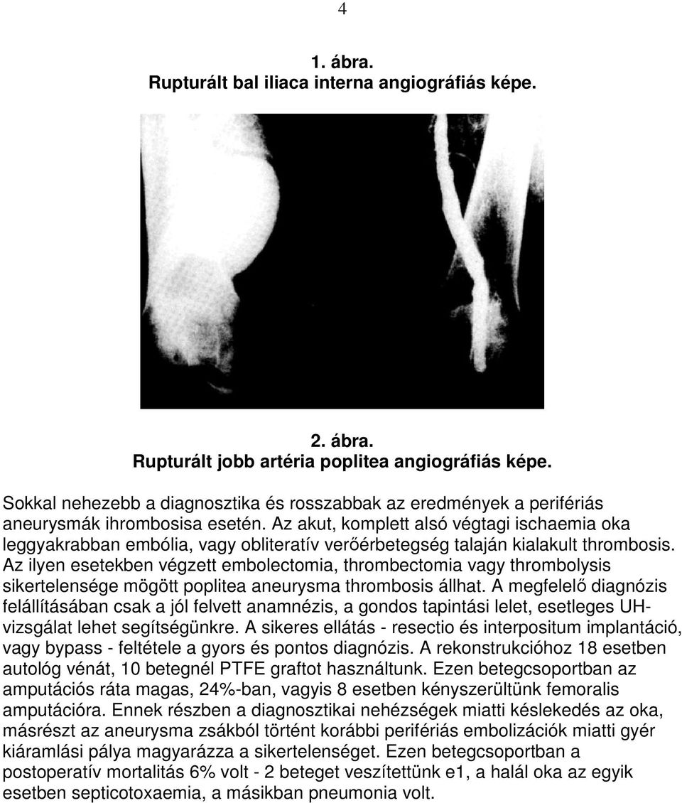 Az akut, komplett alsó végtagi ischaemia oka leggyakrabban embólia, vagy obliteratív verıérbetegség talaján kialakult thrombosis.