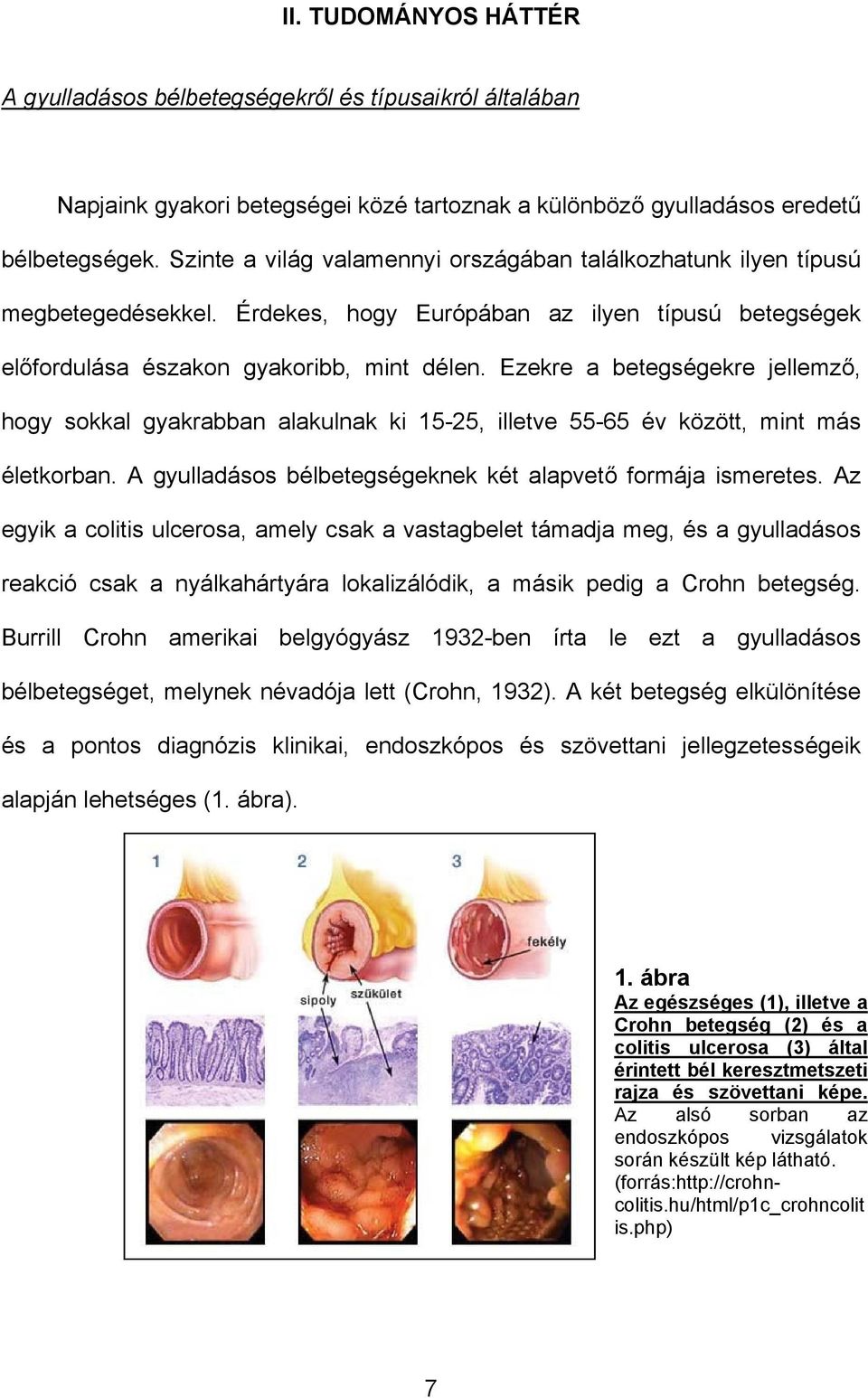 Ezekre a betegségekre jellemző, hogy sokkal gyakrabban alakulnak ki 15-25, illetve 55-65 év között, mint más életkorban. A gyulladásos bélbetegségeknek két alapvető formája ismeretes.