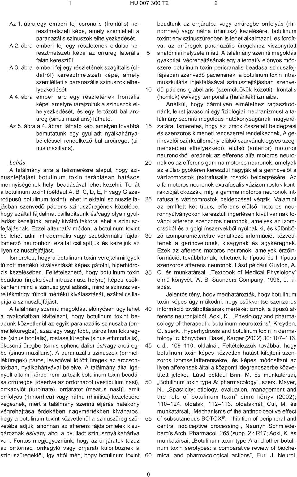 ábra emberi fej egy részletének szagittális (oldalról) keresztmetszeti képe, amely szemlélteti a paranazális szinuszok elhelyezkedését. A 4.