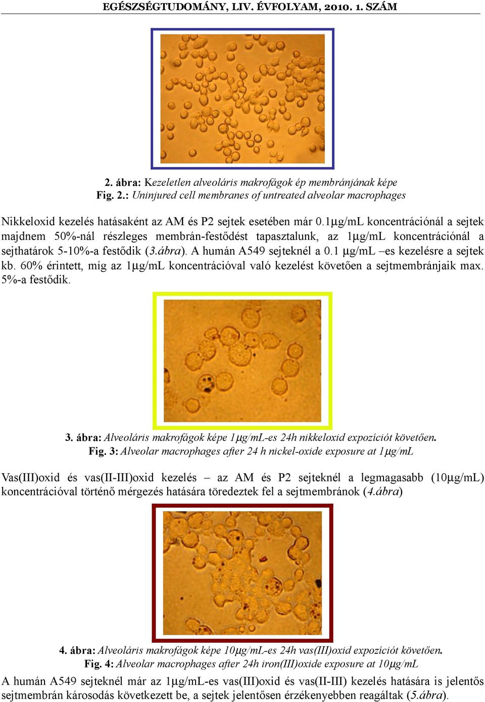 1 µg/ml es kezelésre a sejtek kb. 60% érintett, míg az 1µg/mL koncentrációval való kezelést követően a sejtmembránjaik max. 5%-a festődik. 3.