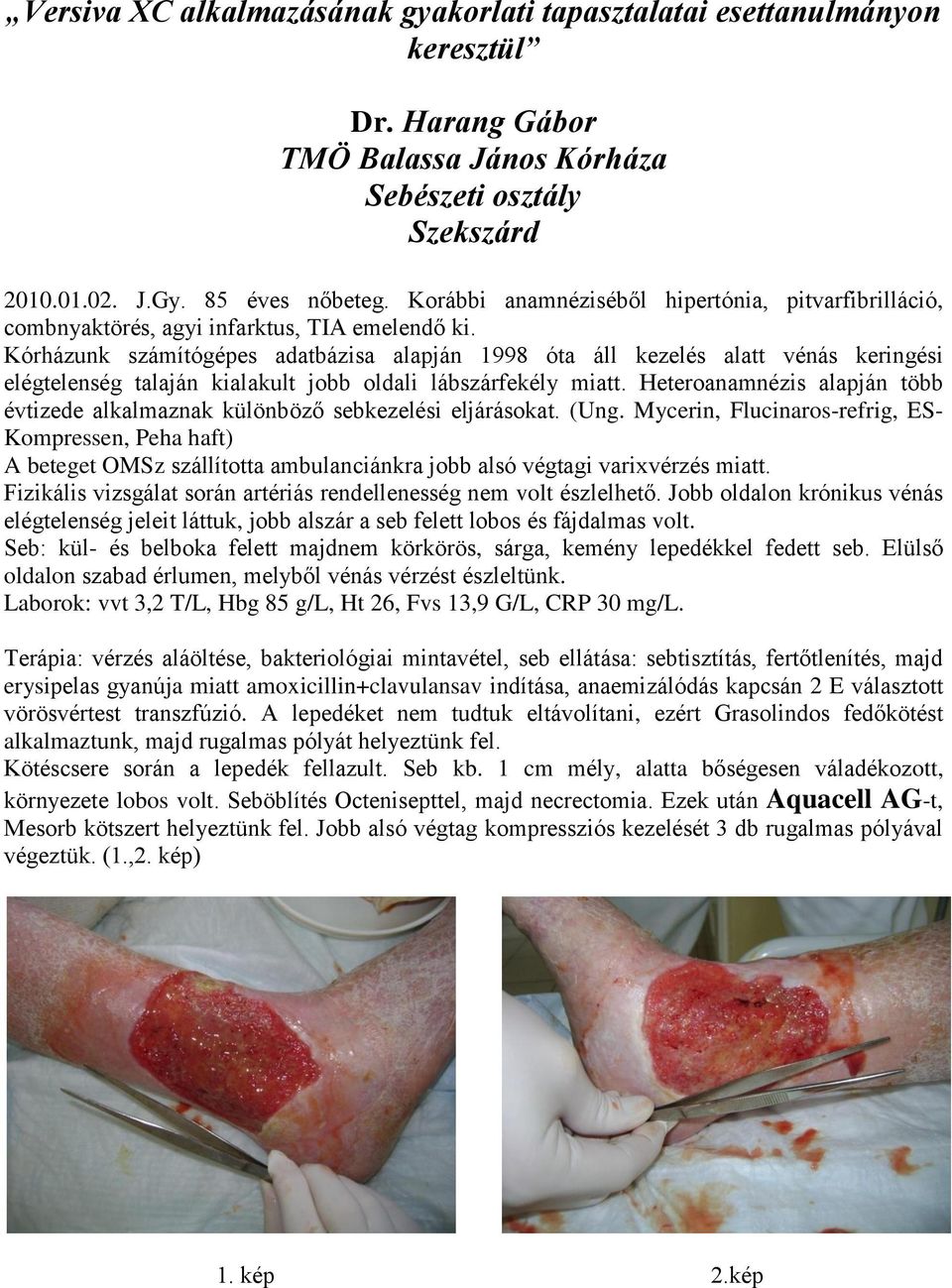 Kórházunk számítógépes adatbázisa alapján 1998 óta áll kezelés alatt vénás keringési elégtelenség talaján kialakult jobb oldali lábszárfekély miatt.