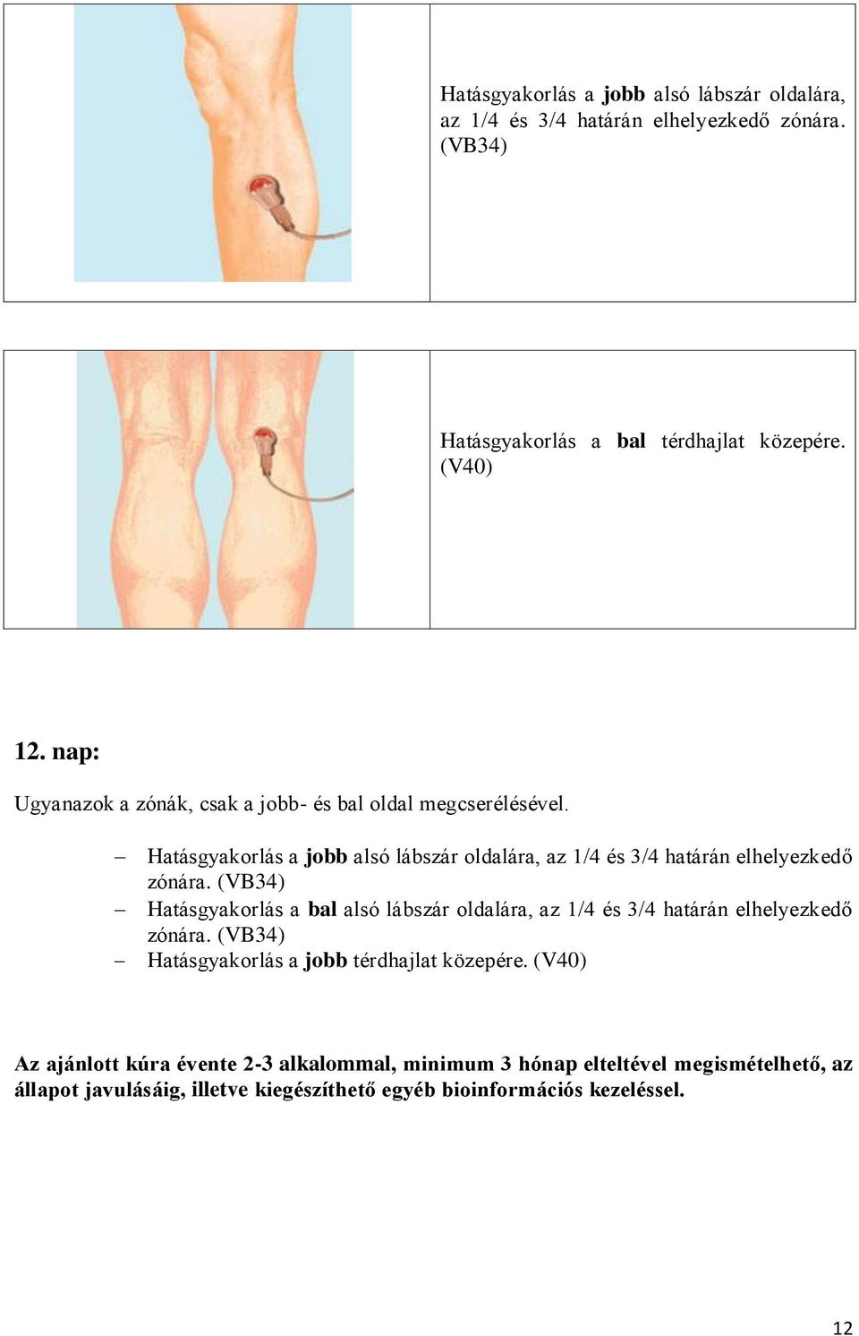 (VB34) Hatásgyakorlás a bal alsó lábszár oldalára, az 1/4 és 3/4 határán elhelyezkedő zónára.