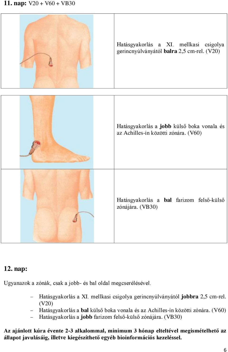 nap: Hatásgyakorlás a XI. mellkasi csigolya gerincnyúlványától jobbra 2,5 cm-rel. (V20) Hatásgyakorlás a bal külső boka vonala és az Achilles-ín közötti zónára.