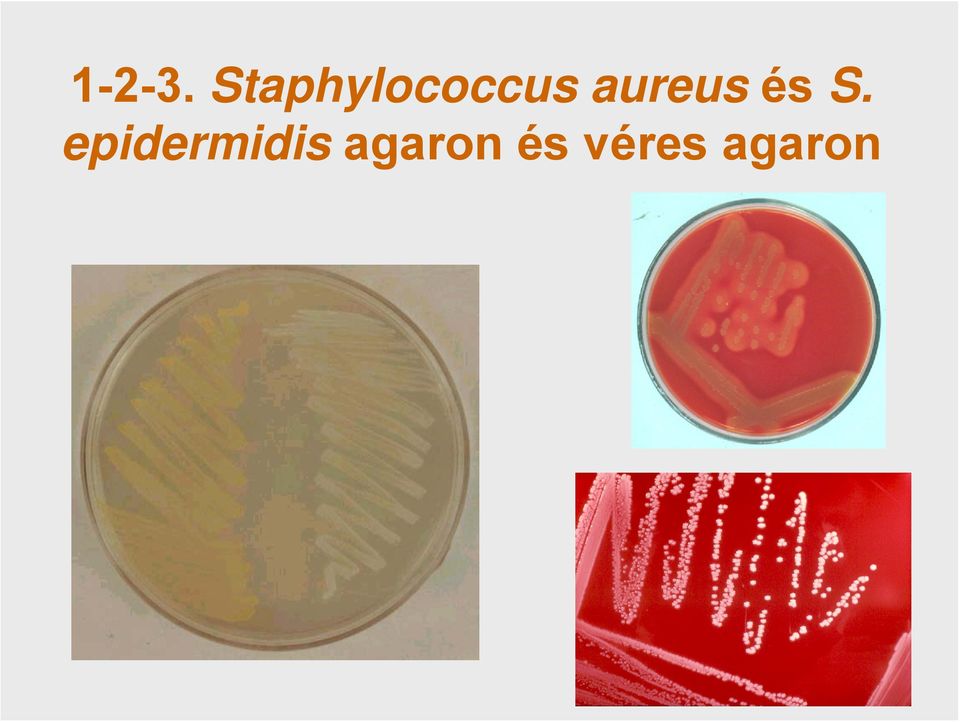 aureus és S.