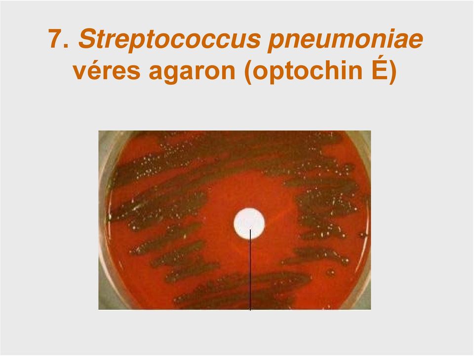 pneumoniae