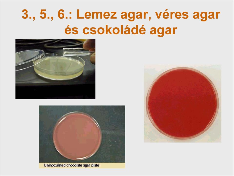 agar, véres