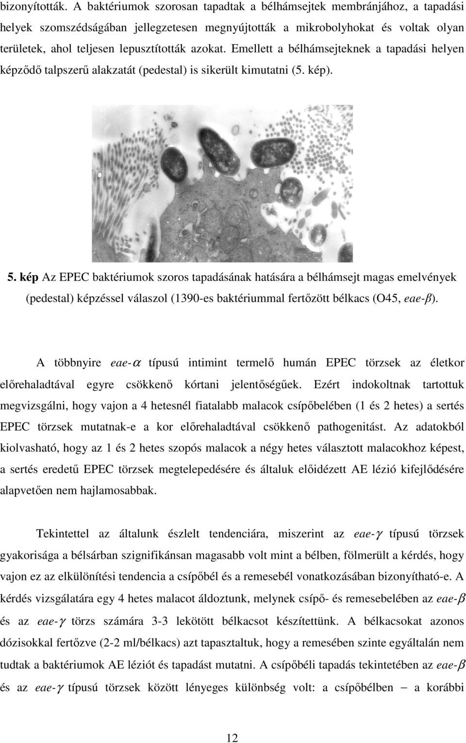 azokat. Emellett a bélhámsejteknek a tapadási helyen képződő talpszerű alakzatát (pedestal) is sikerült kimutatni (5. kép). 5.