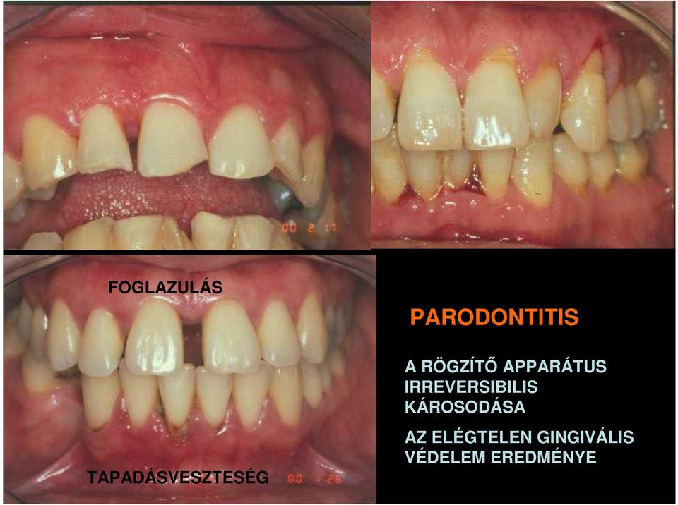 IRREVERSIBILIS KÁROSODÁSA