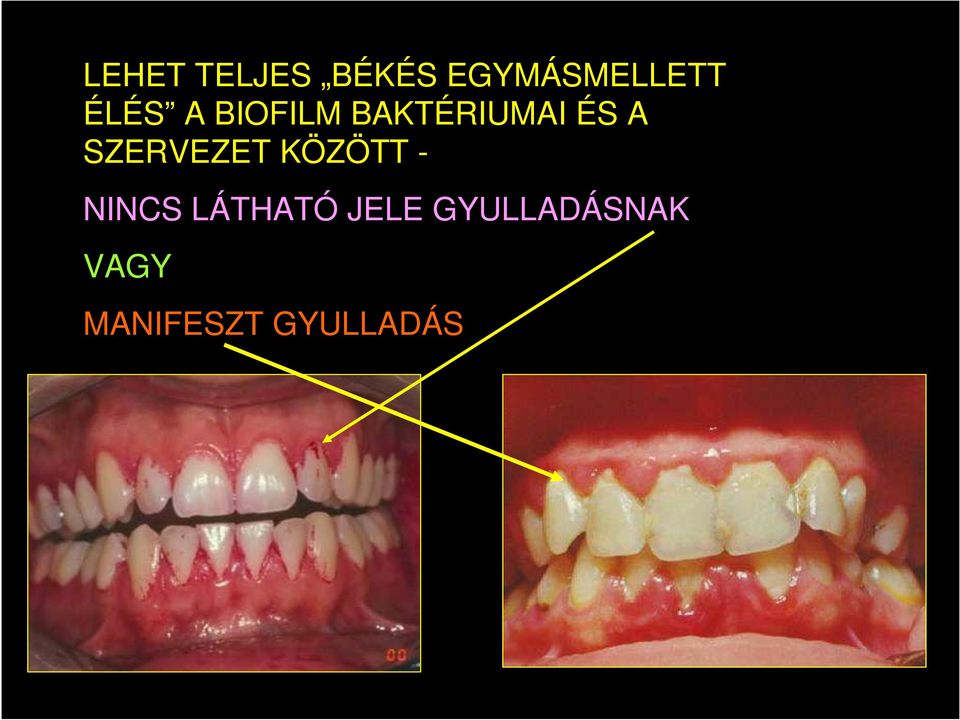 SZERVEZET KÖZÖTT - NINCS LÁTHATÓ