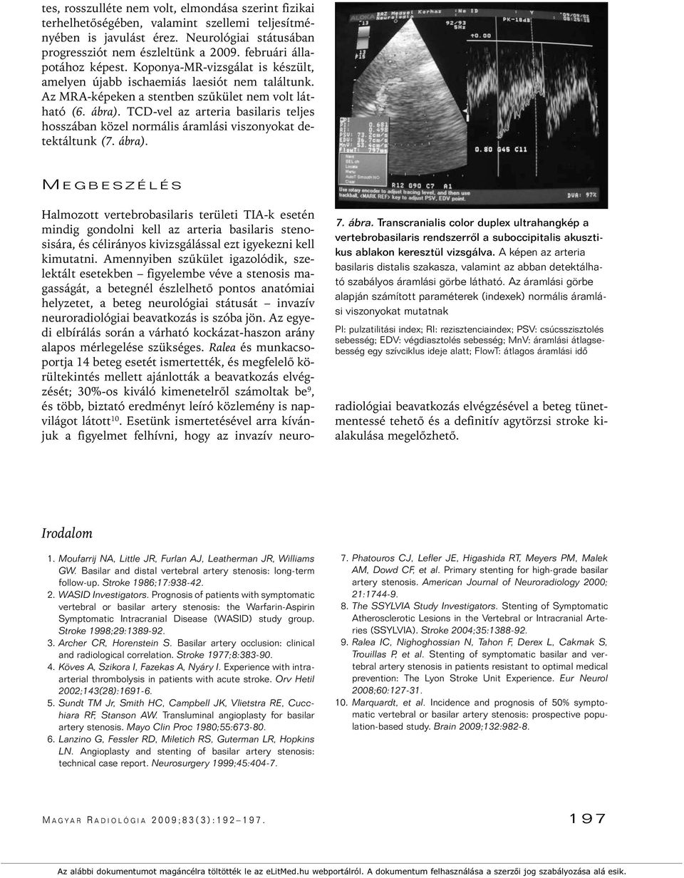 TCD-vel az arteria basilaris teljes hosszában közel normális áramlási viszonyokat detektáltunk (7. ábra)