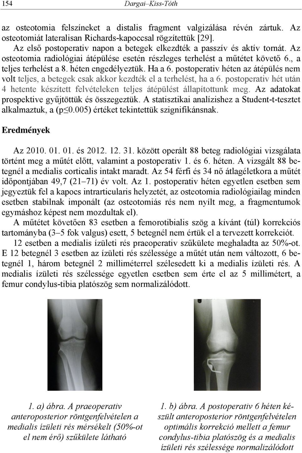 héten engedélyeztük. Ha a 6. postoperativ héten az átépülés nem volt teljes, a betegek csak akkor kezdték el a terhelést, ha a 6.