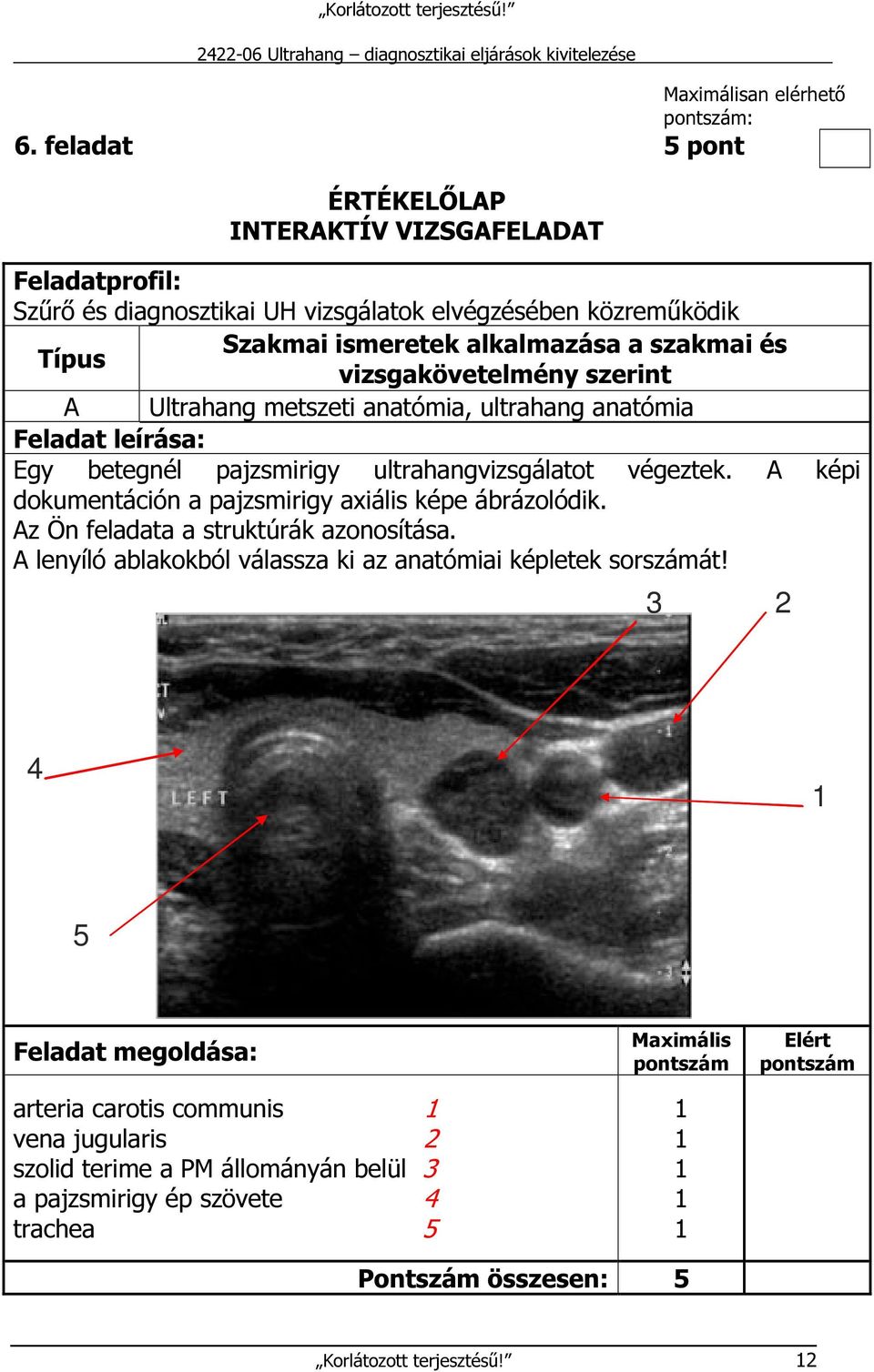 vizsgakövetelmény szerint A Ultrahang metszeti anatómia, ultrahang anatómia Feladat leírása: Egy betegnél pajzsmirigy ultrahangvizsgálatot végeztek.