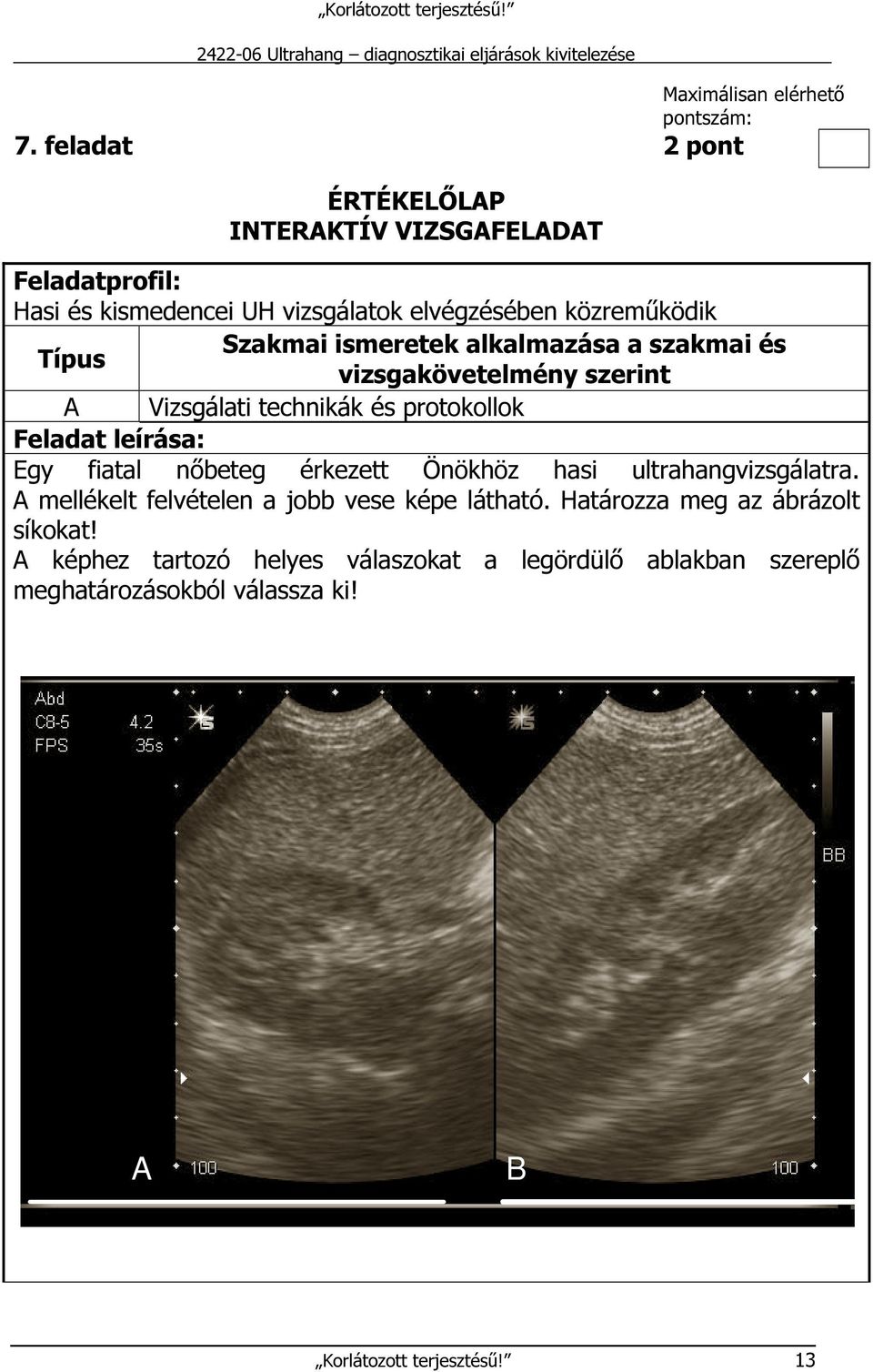 ismeretek alkalmazása a szakmai és Típus vizsgakövetelmény szerint A Vizsgálati technikák és protokollok Feladat leírása: Egy fiatal