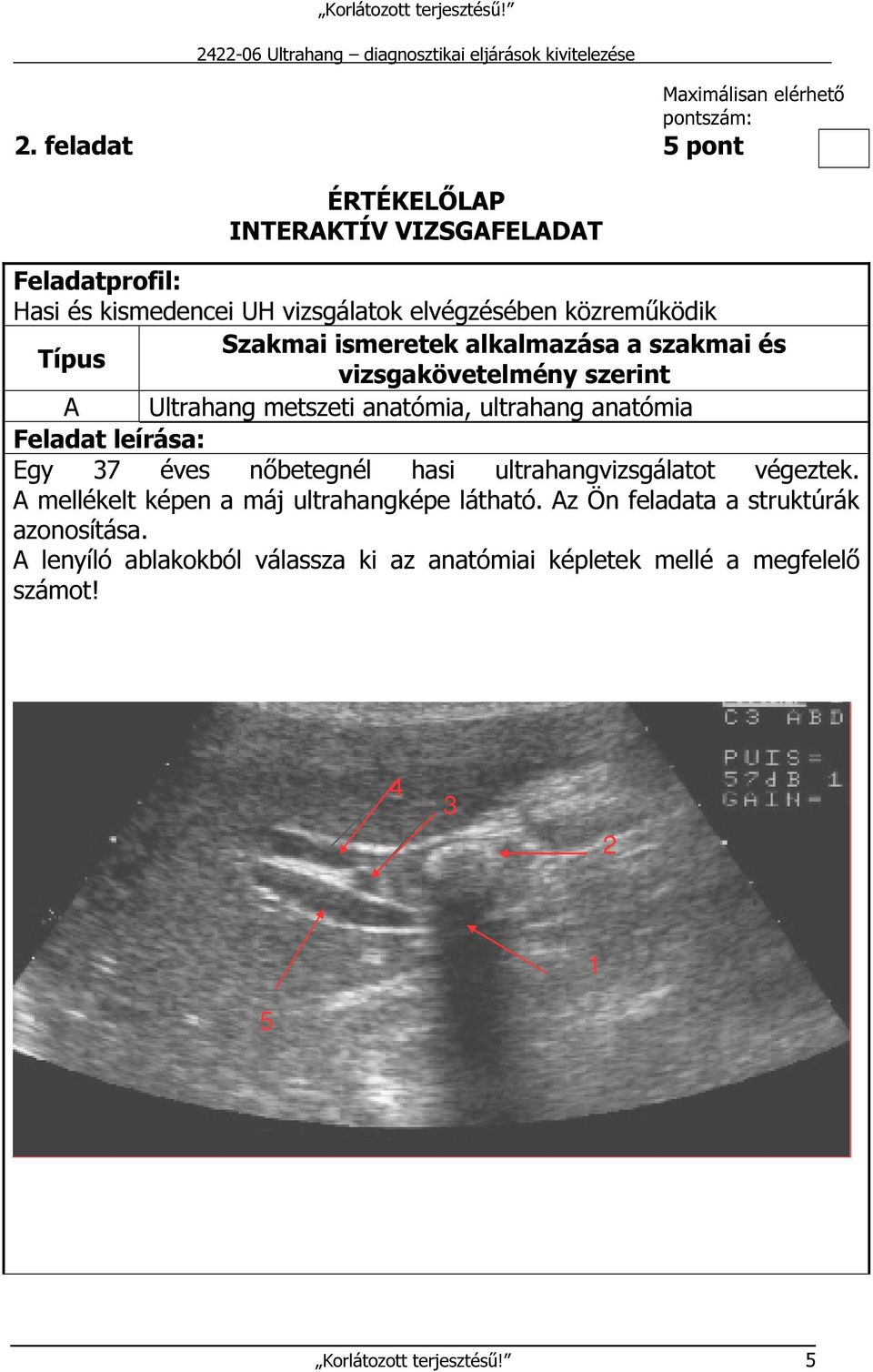 ismeretek alkalmazása a szakmai és Típus vizsgakövetelmény szerint A Ultrahang metszeti anatómia, ultrahang anatómia Feladat leírása: Egy