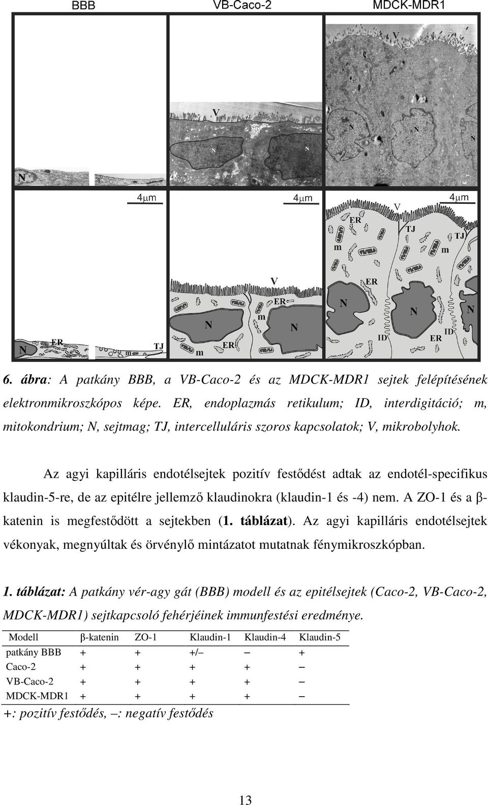 Az agyi kapilláris endotélsejtek pozitív fest dést adtak az endotél-specifikus klaudin-5-re, de az epitélre jellemz klaudinokra (klaudin-1 és -4) nem.