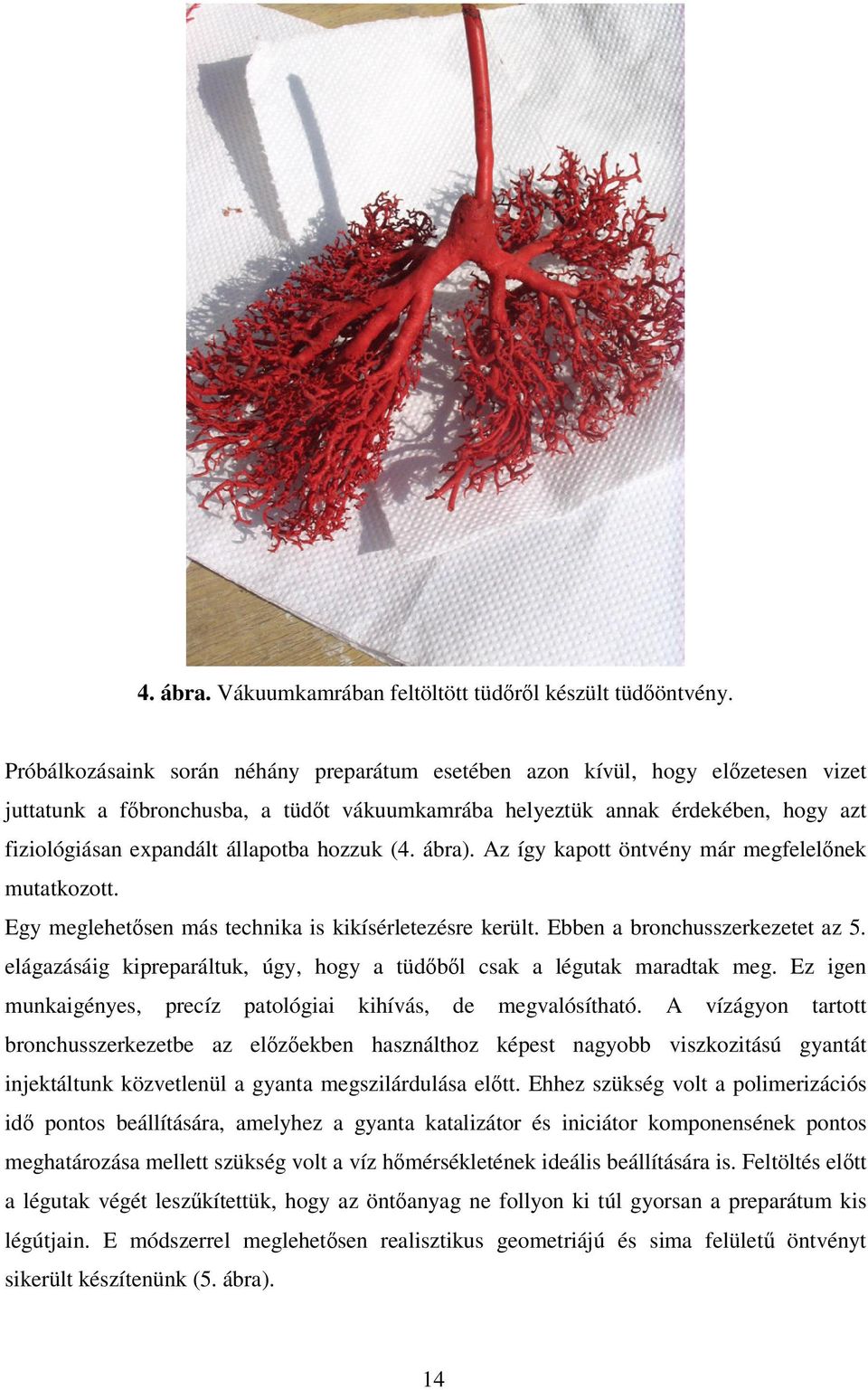 hozzuk (4. ábra). Az így kapott öntvény már megfelelnek mutatkozott. Egy meglehetsen más technika is kikísérletezésre került. Ebben a bronchusszerkezetet az 5.