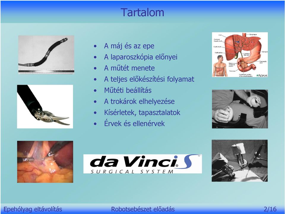 trokárok elhelyezése Kísérletek, tapasztalatok Érvek és