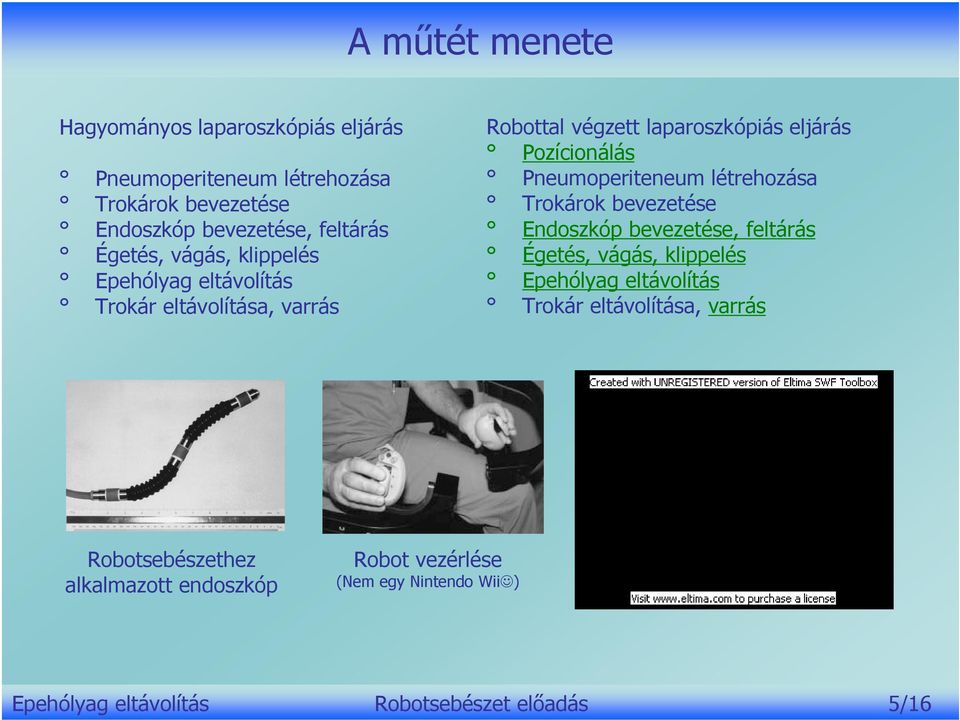 Pneumoperiteneum létrehozása Trokárok bevezetése Endoszkóp bevezetése, feltárás Égetés, vágás, klippelés Epehólyag eltávolítás Trokár