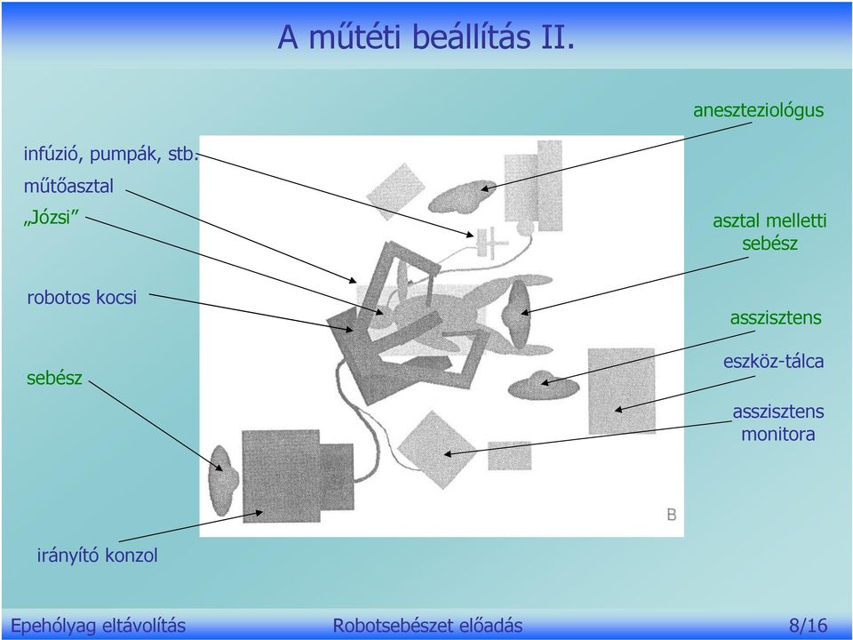 műtőasztal Józsi asztal melletti sebész robotos kocsi