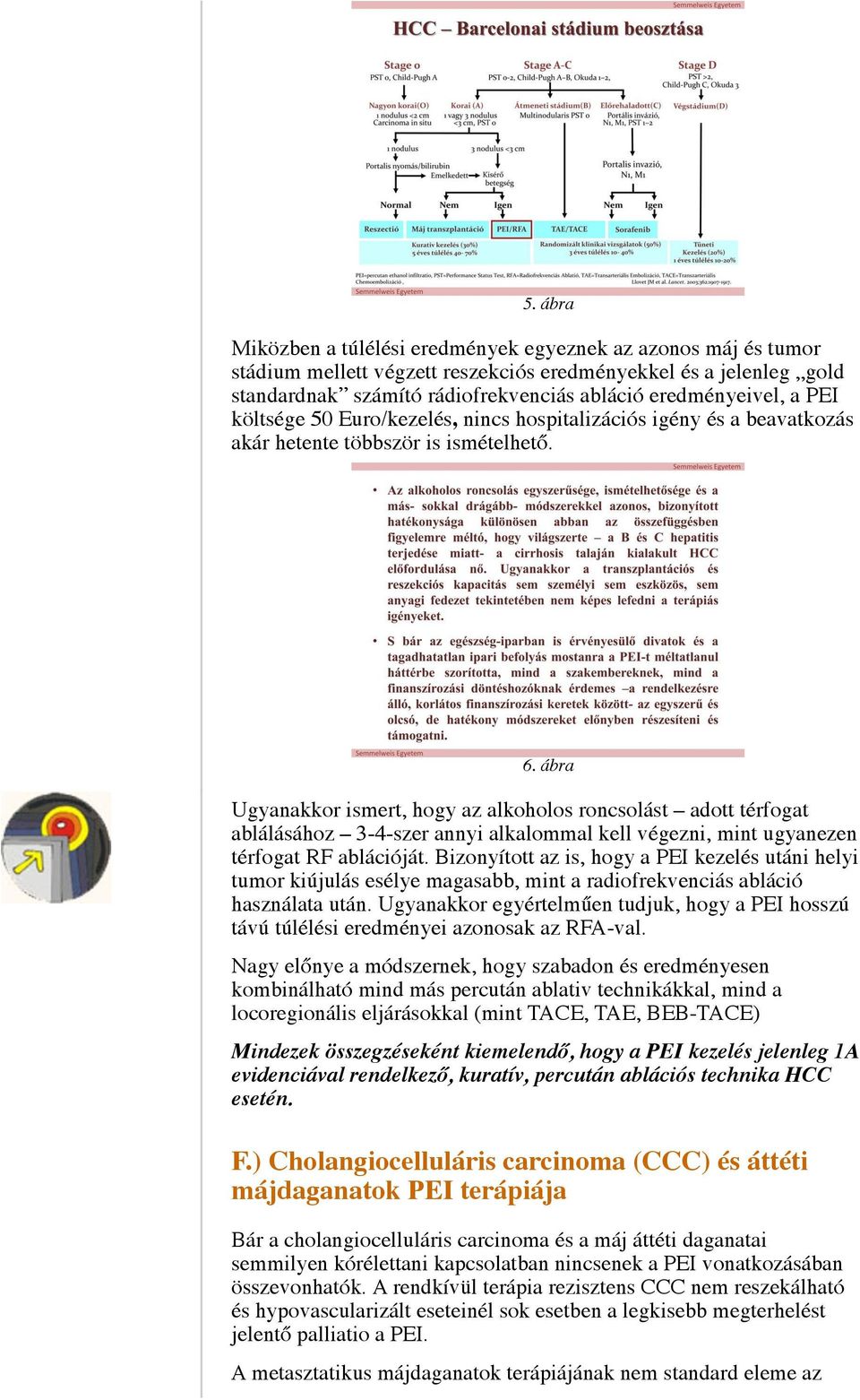 ábra Ugyanakkor ismert, hogy az alkoholos roncsolást adott térfogat ablálásához 3-4-szer annyi alkalommal kell végezni, mint ugyanezen térfogat RF ablációját.