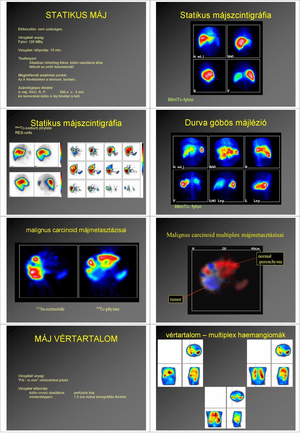Számítógépes felvétel: A máj, RAO, R, P: 500 e v. 3 min. kis kameránál külön A lép felvétel is kell.