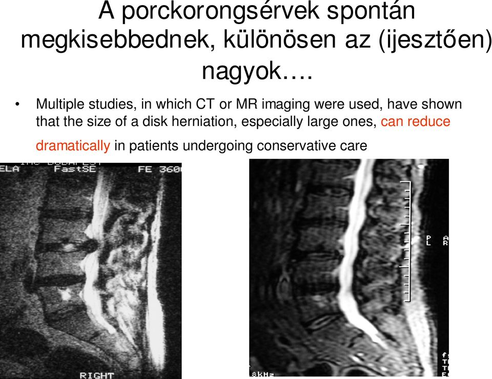 Multiple studies, in which CT or MR imaging were used, have shown