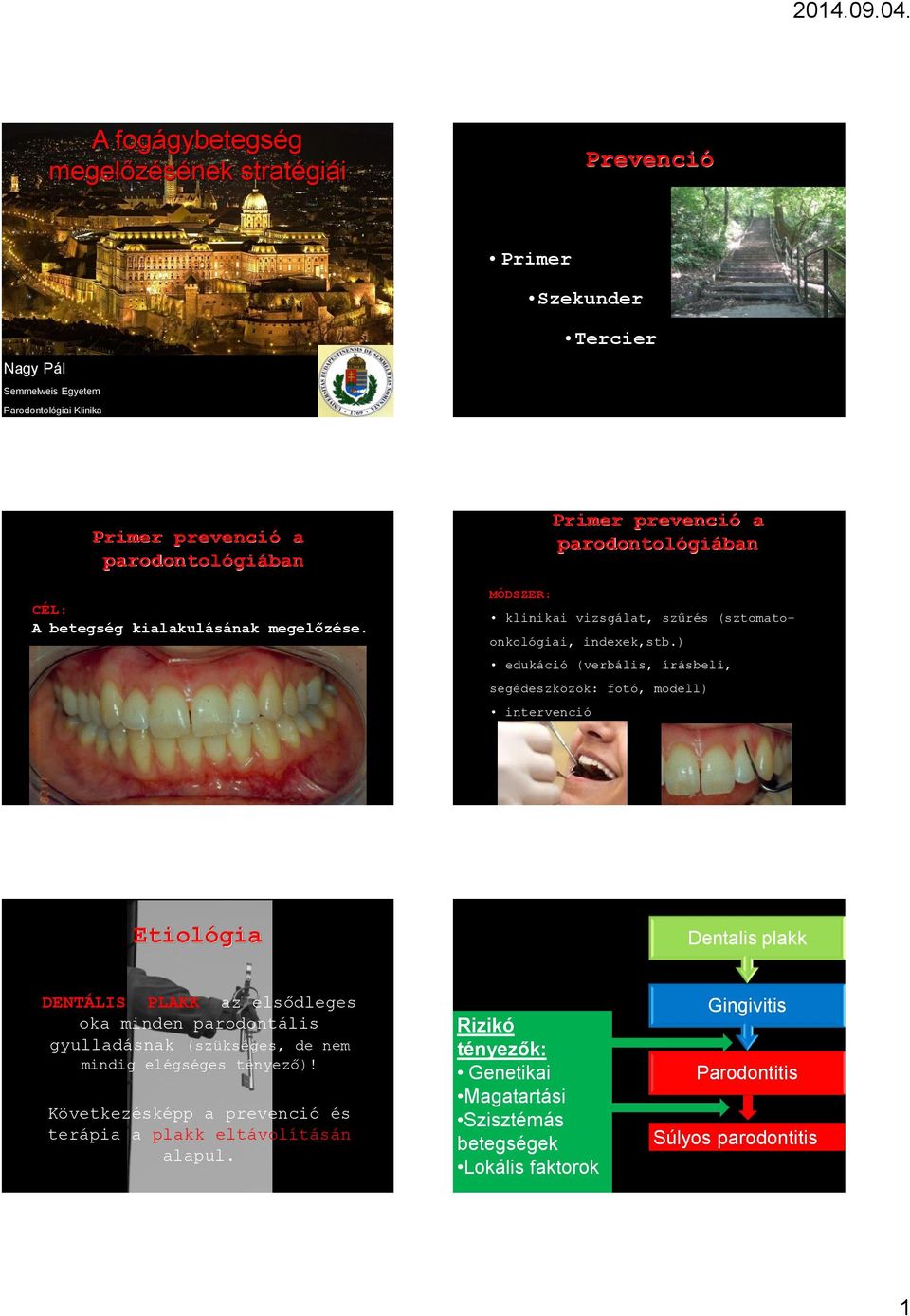) edukáció (verbális, írásbeli, segédeszközök: fotó, modell) intervenció Etiológia Dentalis plakk DENTÁLIS PLAKK az elsődleges oka minden parodontális