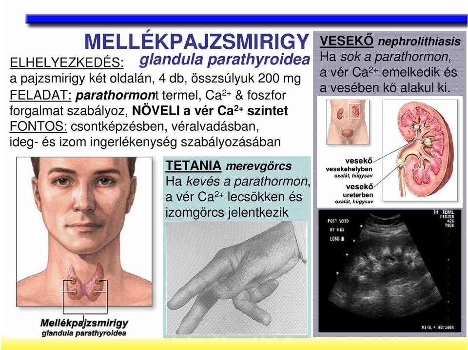 véralvadásban, ideg- és izom ingerlékenység szabályozásában VESEKİ nephrolithiasis Ha sok a parathormon, a vér Ca 2+