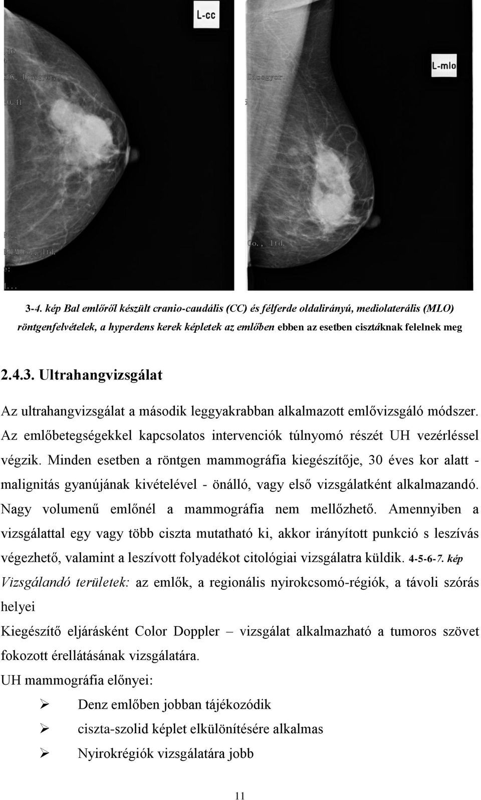 Minden esetben a röntgen mammográfia kiegészítője, 30 éves kor alatt - malignitás gyanújának kivételével - önálló, vagy első vizsgálatként alkalmazandó.