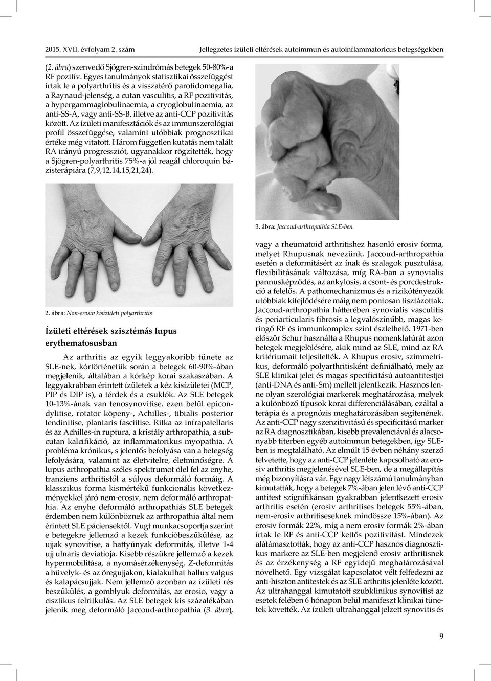 cryoglobulinaemia, az anti-ss-a, vagy anti-ss-b, illetve az anti-ccp pozitivitás között.