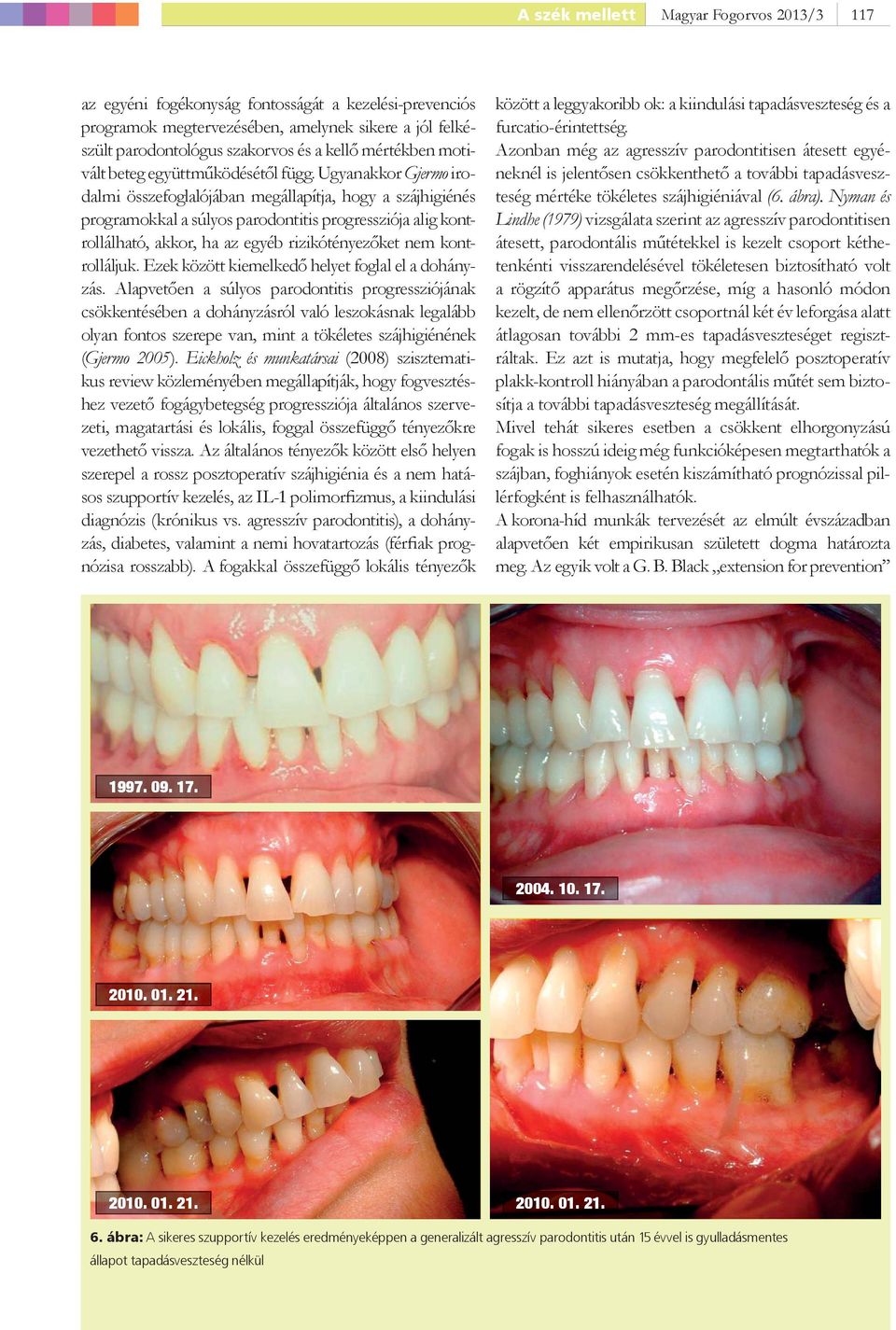 Ugyanakkor Gjermo irodalmi összefoglalójában megállapítja, hogy a szájhigiénés programokkal a súlyos parodontitis progressziója alig kontrollálható, akkor, ha az egyéb rizikótényezőket nem