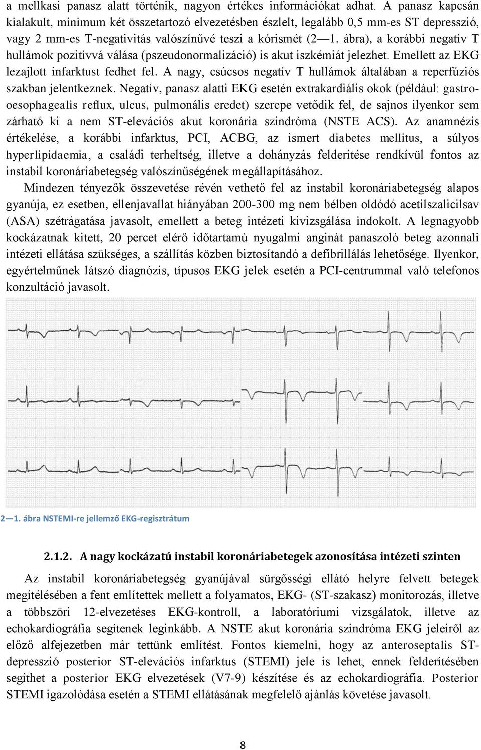 ábra), a korábbi negatív T hullámok pozitívvá válása (pszeudonormalizáció) is akut iszkémiát jelezhet. Emellett az EKG lezajlott infarktust fedhet fel.