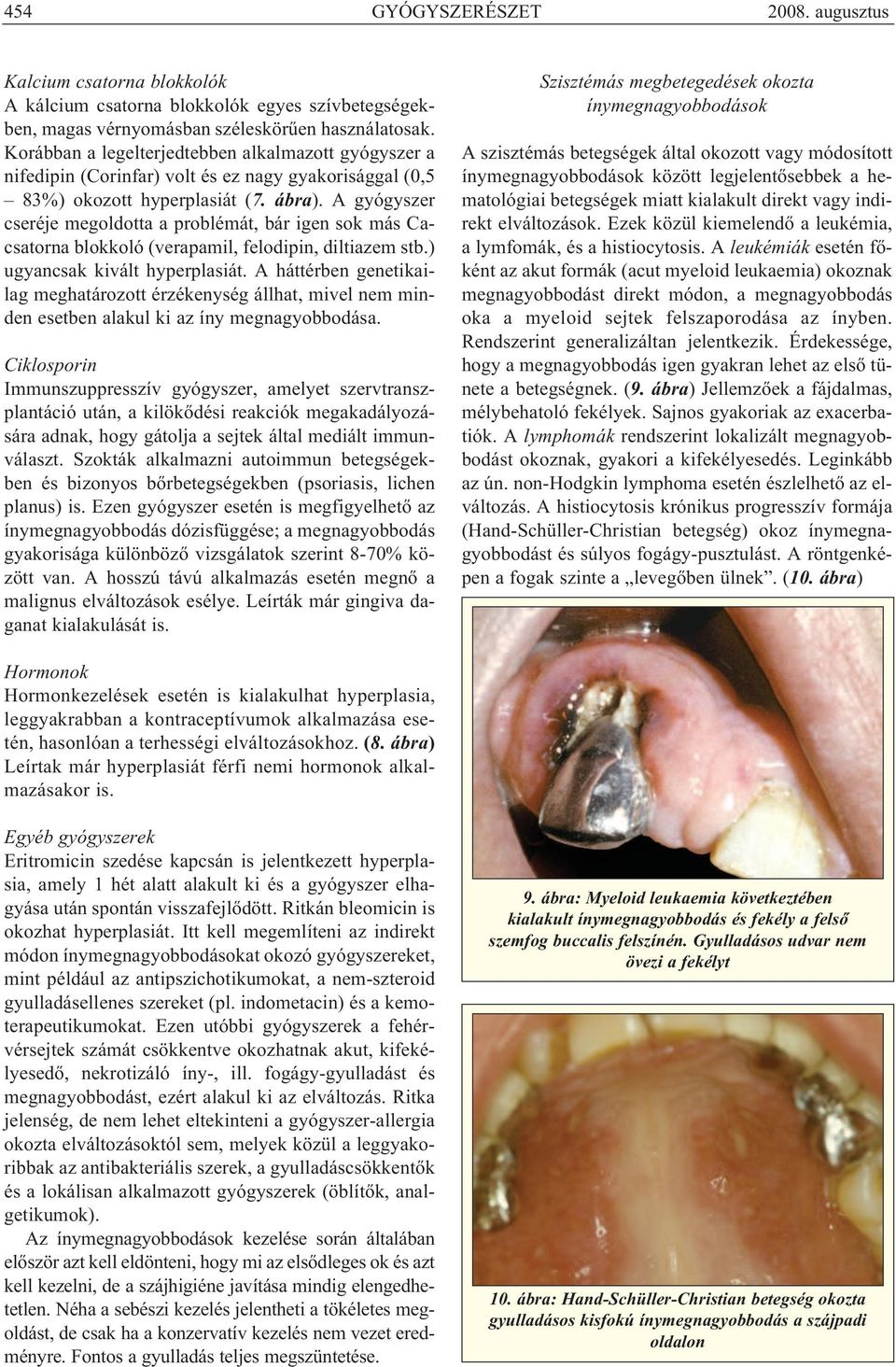 A gyógyszer cseréje megoldotta a problémát, bár igen sok más Cacsatorna blokkoló (verapamil, felodipin, diltiazem stb.) ugyancsak kivált hyperplasiát.