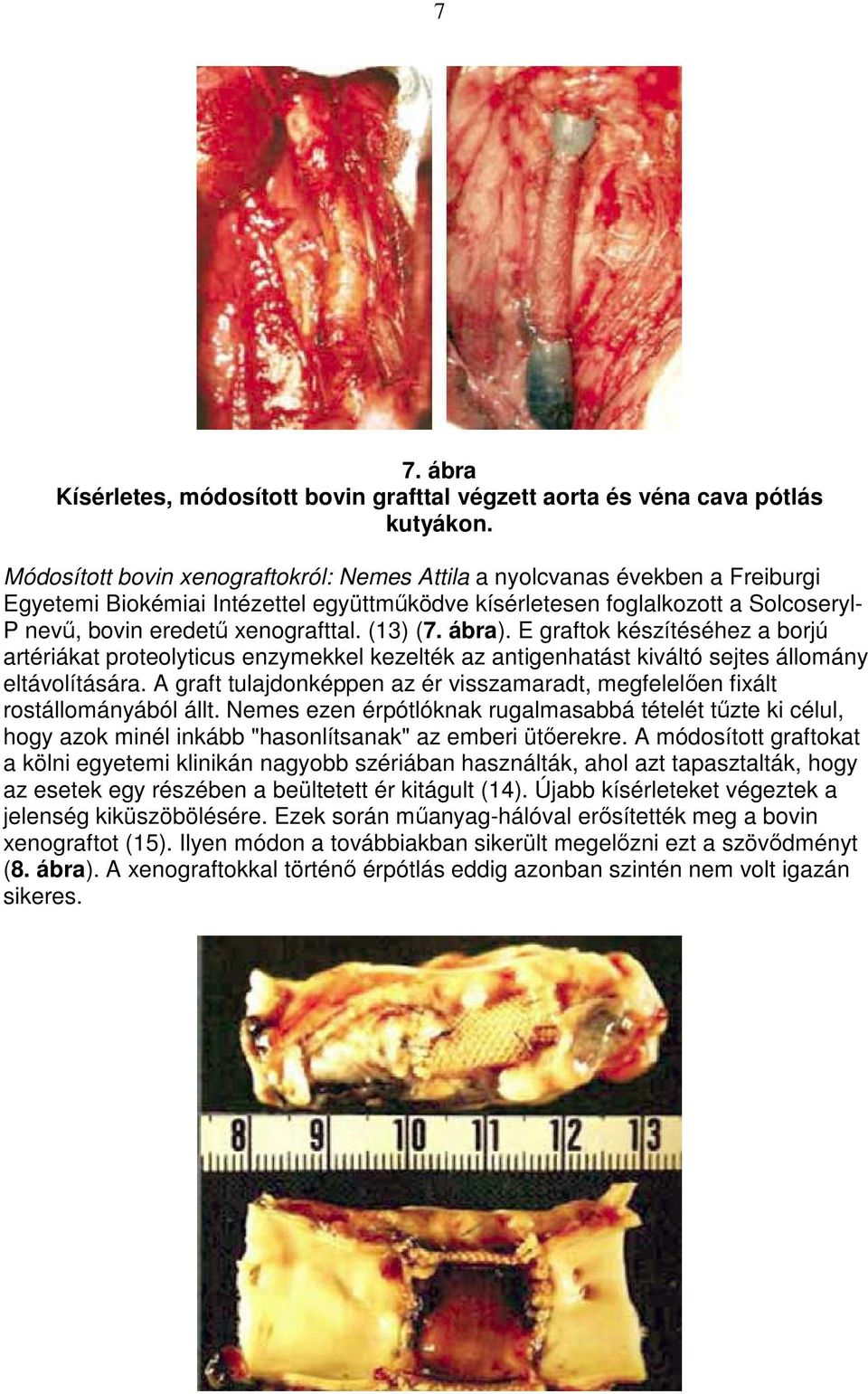 (13) (7. ábra). E graftok készítéséhez a borjú artériákat proteolyticus enzymekkel kezelték az antigenhatást kiváltó sejtes állomány eltávolítására.