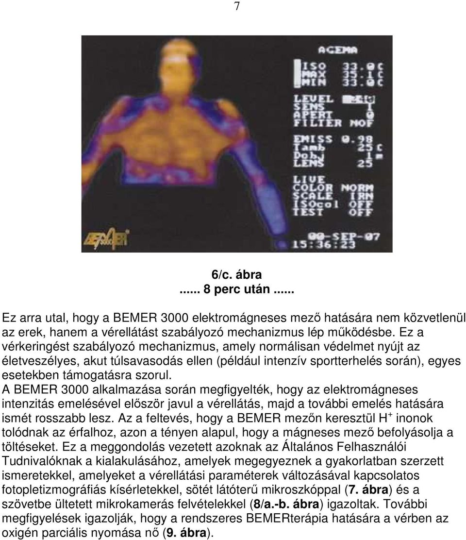 A BEMER 3000 alkalmazása során megfigyelték, hogy az elektromágneses intenzitás emelésével elıször javul a vérellátás, majd a további emelés hatására ismét rosszabb lesz.