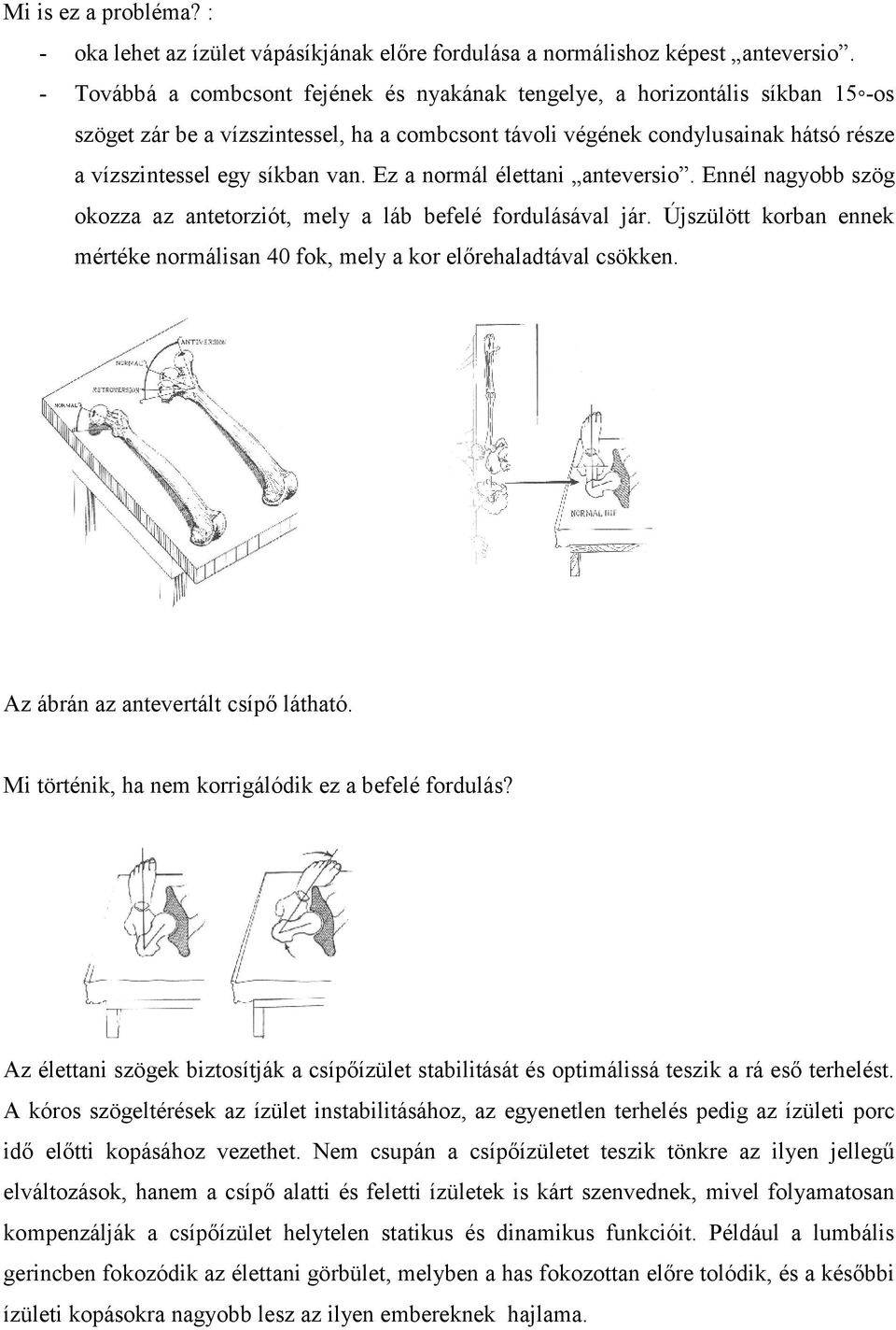 Ez a normál élettani anteversio. Ennél nagyobb szög okozza az antetorziót, mely a láb befelé fordulásával jár. Újszülött korban ennek mértéke normálisan 40 fok, mely a kor előrehaladtával csökken.