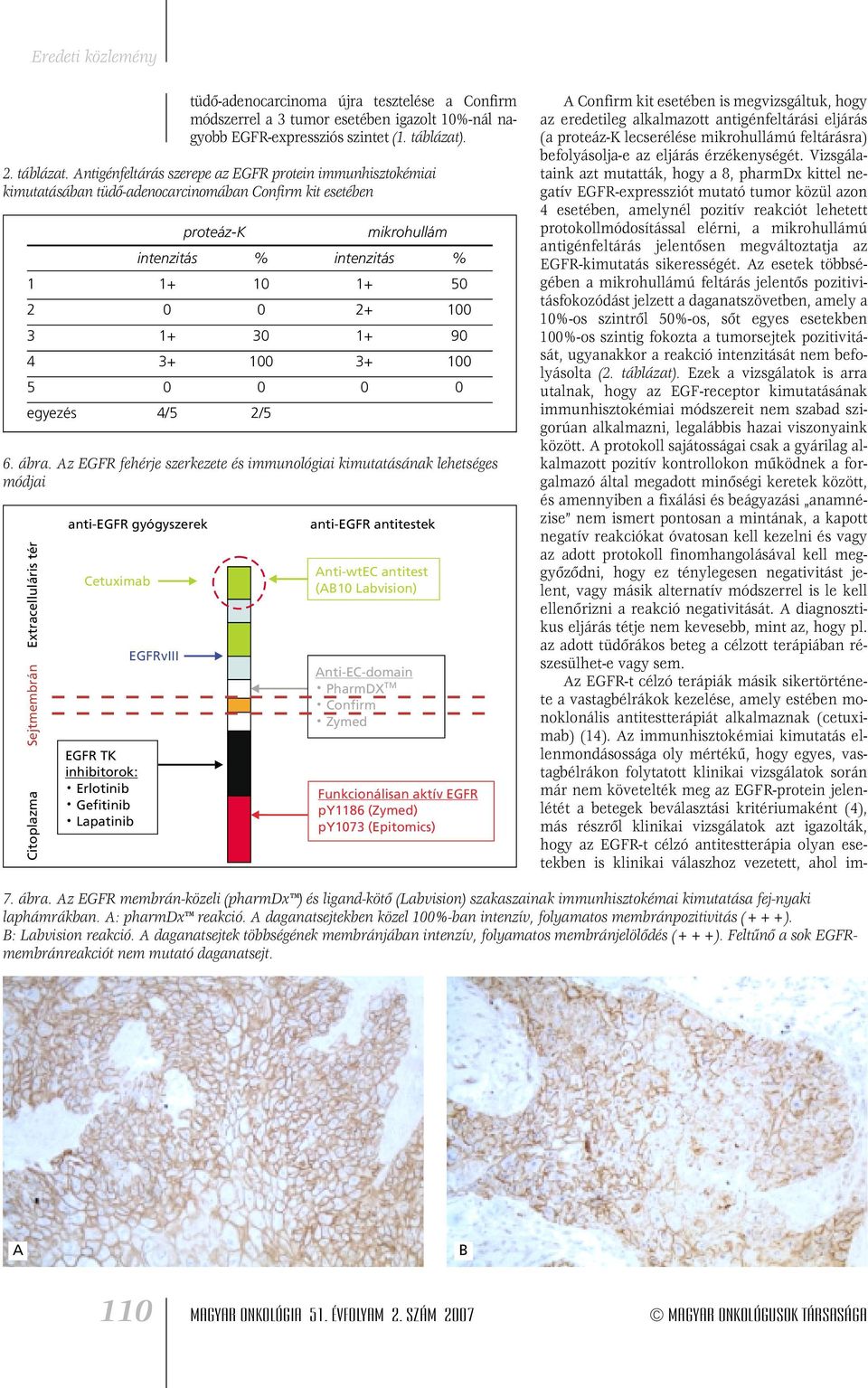 Antigénfeltárás szerepe az EGFR protein immunhisztokémiai kimutatásában tüdô-adenocarcinomában Confirm kit esetében proteáz-k mikrohullám intenzitás % intenzitás % 1 1+ 10 1+ 50 2 0 0 2+ 100 3 1+ 30