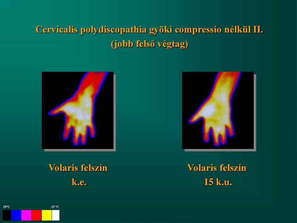 (jobb felső végtag) Volaris