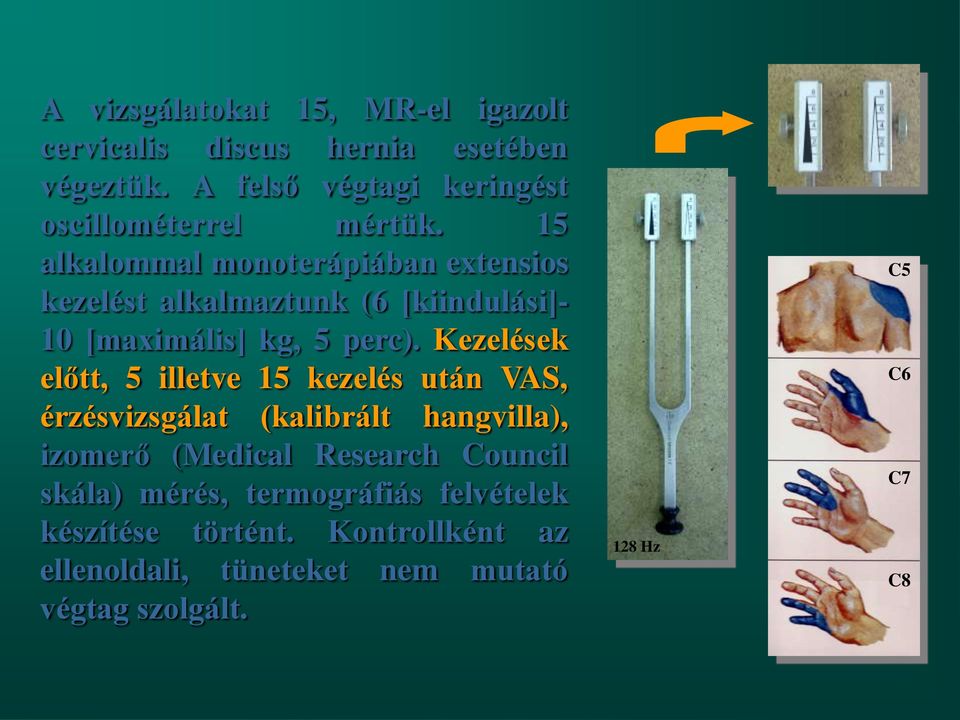 15 alkalommal monoterápiában extensios kezelést alkalmaztunk (6 [kiindulási]- 10 [maximális] kg, 5 perc).