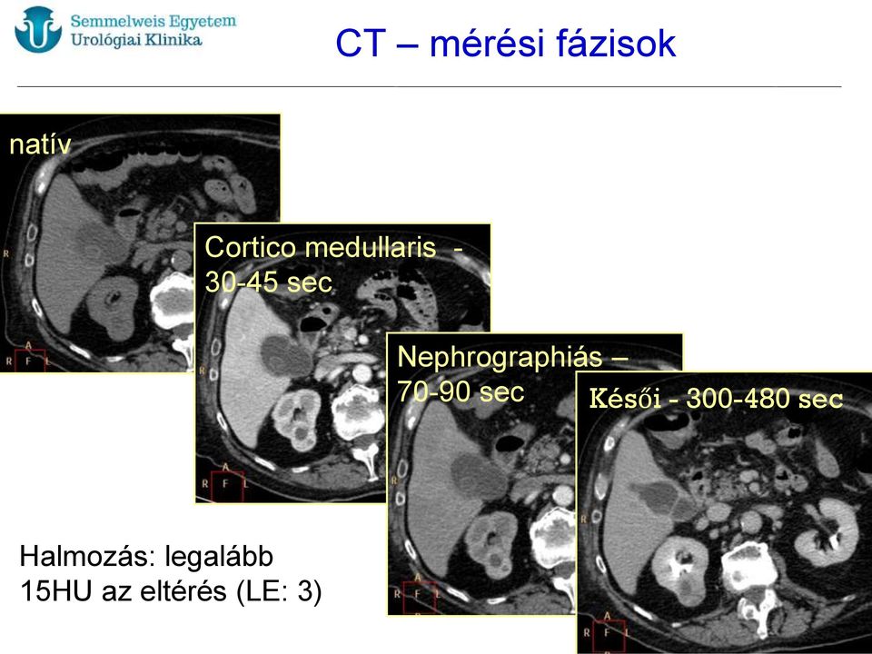 Nephrographiás 70-90 sec Késői -