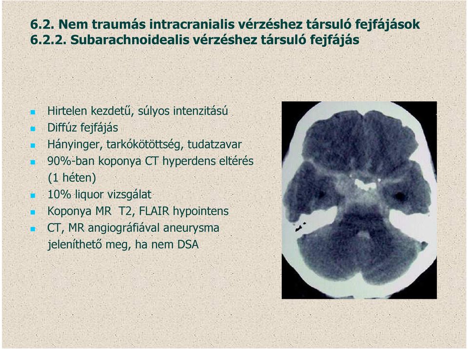 tarkókötöttség, tudatzavar 90%-ban koponya CT hyperdens eltérés (1 héten) 10% liquor